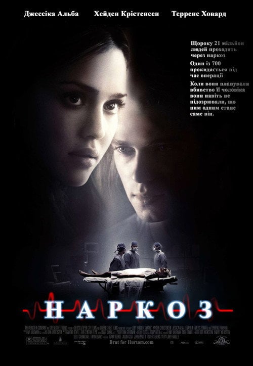 Постер Наркоз (2007)